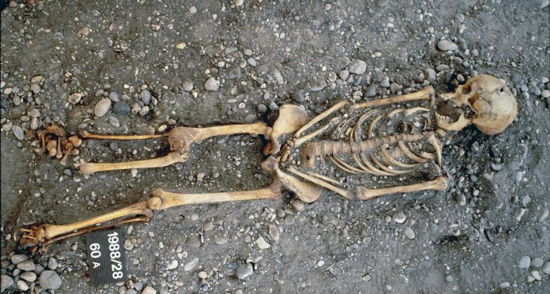 The skeletal remains of a documented female tailor from 19th century Basel, whose specialized manual activities are reflected on her hand bones. 