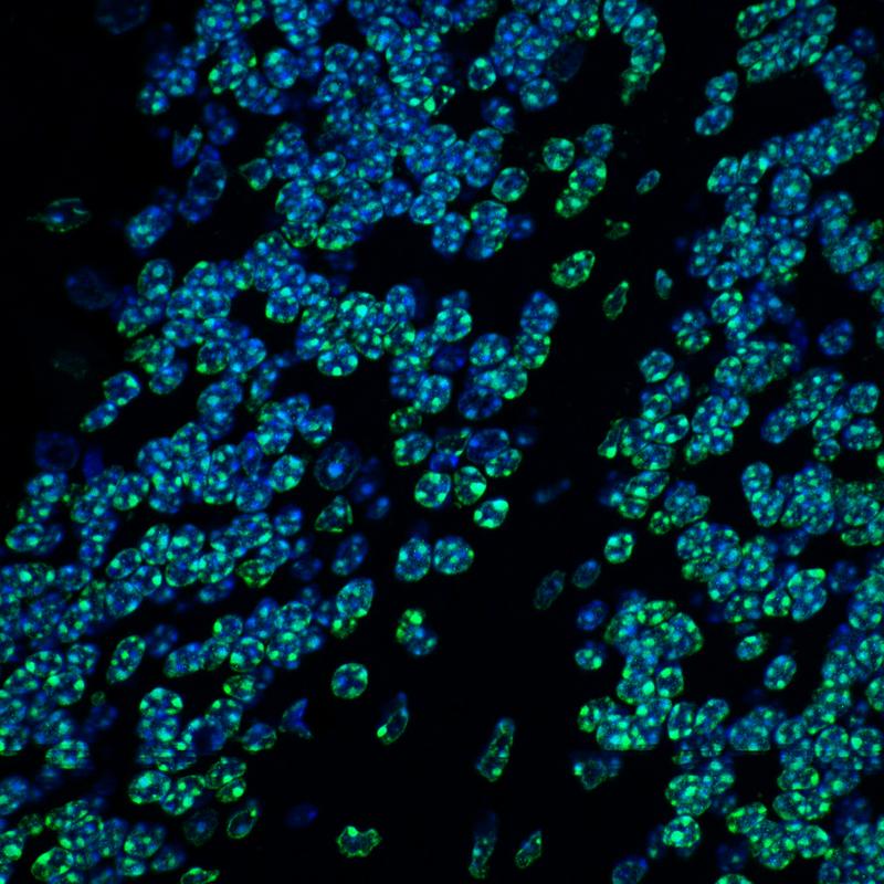 Immunfluoreszenzfärbung des Mäusegehirns