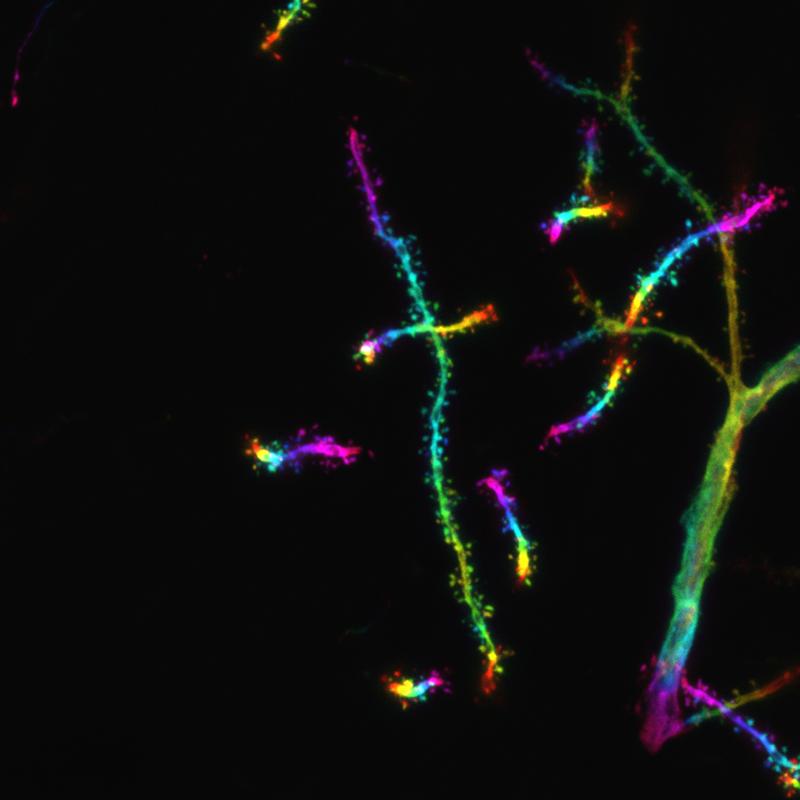 Visualisierung neuronaler Synapsen im Mausgehirn