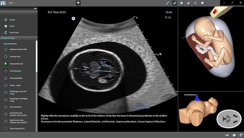 Trainingsmodus: Die Vermessung des Herzens mittels Ultraschall kann mit dem Simulator geübt werden