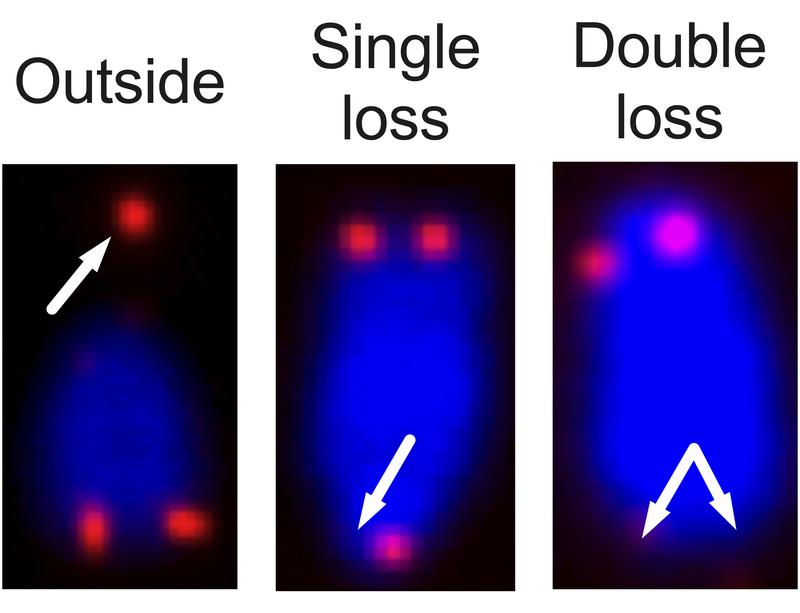 Missing and broken off telomers illustrate how DNA damage occurs in cells lacking SAMHD1. However, this DNA damage does not cause activation of the interferon system, instead the cell´s own RNA is sensed. 