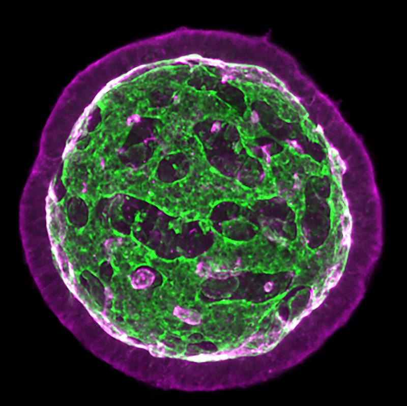 Die komplexe Architektur der neuroepithelialen Organoide entsteht durch epitheliale Fusionsprozesse. Die Zellmembranen sind rot markiert, während die mit Flüssigkeit gefüllten Röhren in Grün dargestellt sind. 