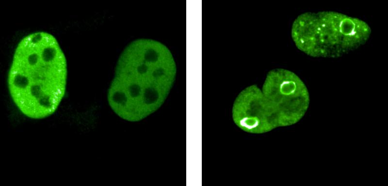MYC-Proteine, grün gefärbt. In normal wachsenden Zellen sind sie gleichmäßig im Zellkern verteilt (l). In Stress-Situationen, wie sie in Krebszellen vorkommen, bilden sie kugelartige Strukturen und umgeben besonders gefährdete Abschnitte des Genoms.