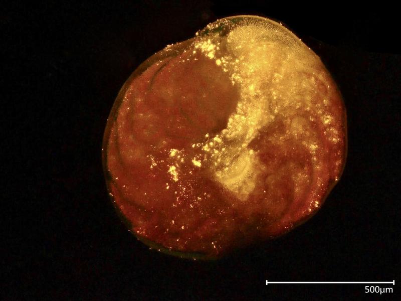 2.	Die große Anzahl fluoreszierender gelber Punkte in dieser Foraminifere sind aufgenommene Nanoplastikteilchen. 