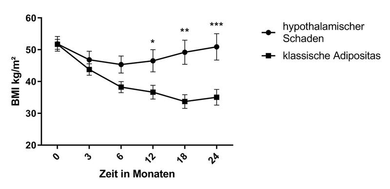 Gewichtsverlauf der Patienten mit hypothalamischem Schaden und klassischer Adipositas nach bariatrischer Chirurgie: Der Gewichtsverlauf unterscheidet sich sehr deutlich. In ersterer Gruppe ist kein dauerhafter gewichtsreduzierender Effekt zu sehen.