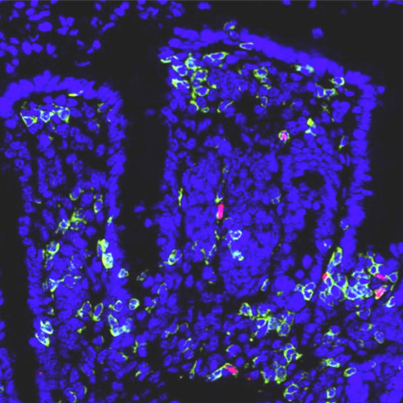 Der neue SFB/TRR 355 der Universitätsmedizin Mainz untersucht den Einfluss von regulatorischen T (Treg)-Zellen auf immunbedingte und gewebespezifische Erkrankungen. Das Ziel ist, Treg-Zellen für eine maßgeschneiderte Therapie einzusetzen. 