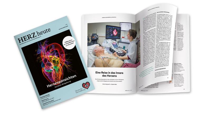 Die Ausgabe HERZ heute 4/2022 mit dem Titel "Herzensansichten - Kardiale Bildgebung" widmet sich den wichtigsten bildgebenden Verfahren zur Diagnose von Herzkrankheiten.