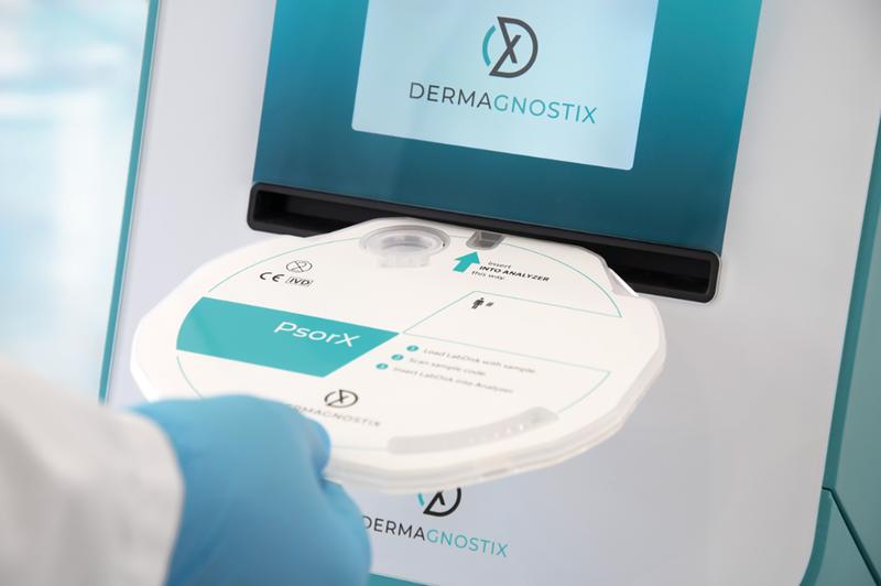 Mit PsorX, dem weltweit ersten Test, der Psoriasis von Ekzemen auf molekularer Ebene unterscheidet, schließt Dermagnostix eine diagnostische Lücke. Die innovativen Produkte sollen das Instrumentarium von Pathologie-Laboren und Krankenhäusern erweitern.