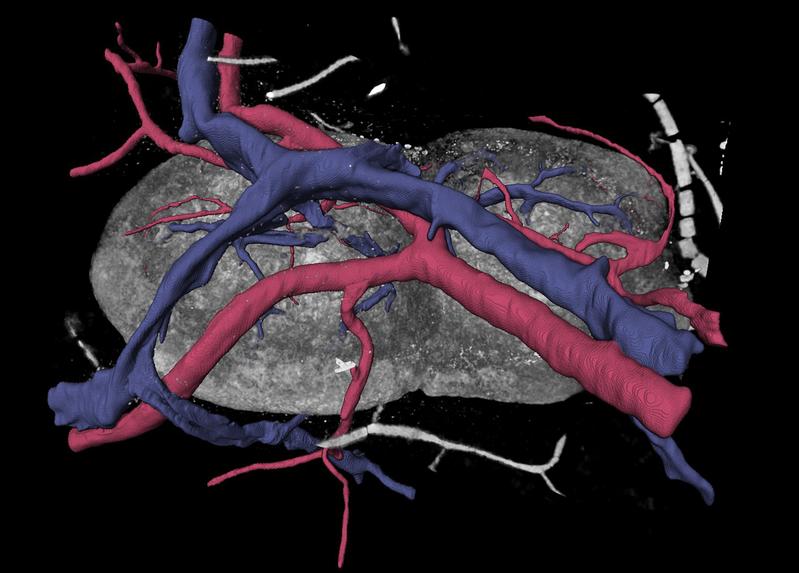 Researchers can now better understand the system of lymph nodes and their blood vessels. Image: Paul Schütz