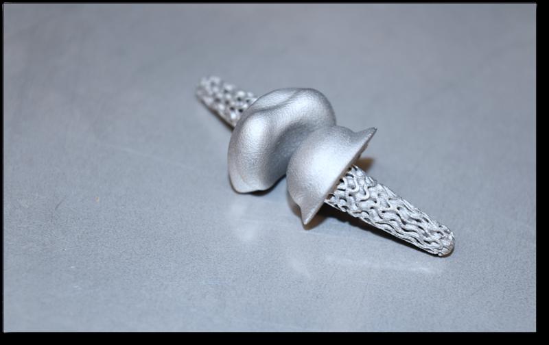 Die FingerKIt-Implantate werden in speziellen 3D-Druck-Verfahren gefertigt.