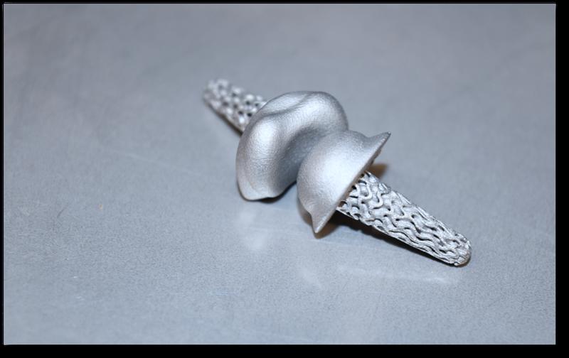 The FingerKIt implants are produced using special 3D printing processes.