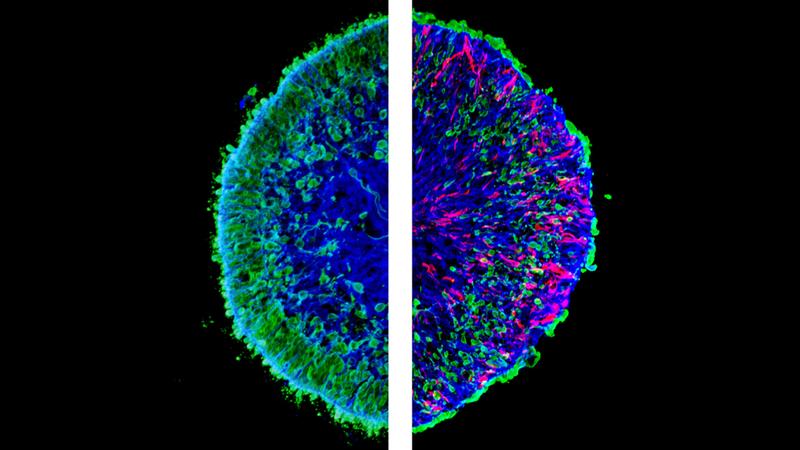 Microscopic images of lab-grown mini-retinas