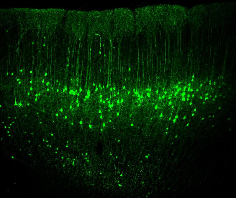 Neurons from layer 5 of the motor cortex stained with a fluorescent dye.