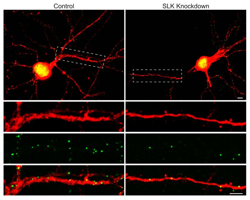 The nerve cell on the right lacks the SLK molecule. As a result, it loses some of its inhibitory postsynapses (green) - these are the "regulators" that reduce the cell's response to a stimulus. 