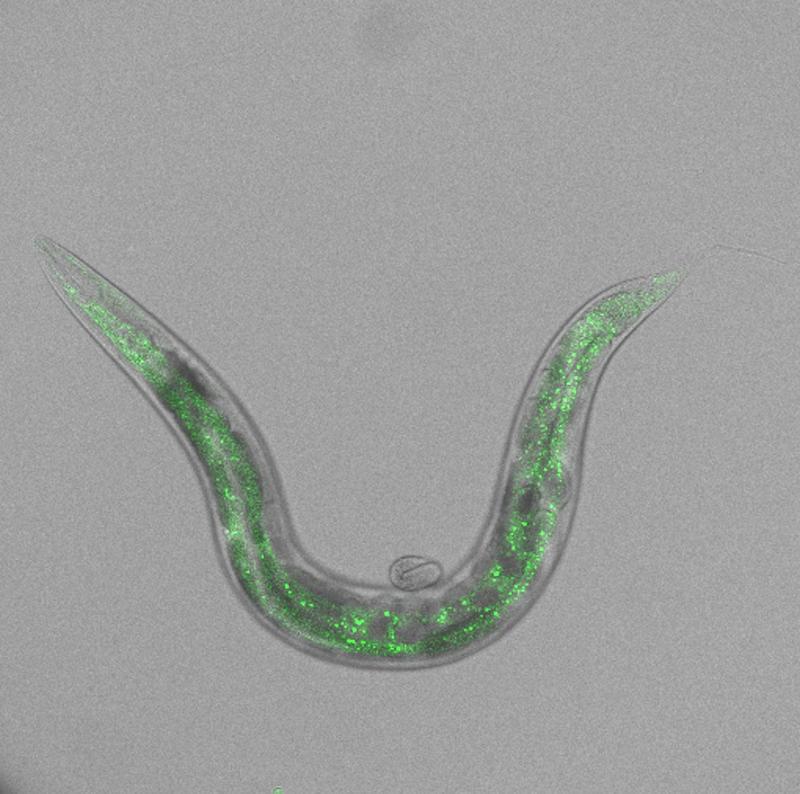 Zu sehen sind ein ausgewachsenes Exemplar des Wurms C. elegans und ein Embryo. In dem erwachsenen Wurm wurde das Protein BCC-1 mit einem fluoreszierenden Protein (GFP) markiert, um dessen Aktivität zu verfolgen.