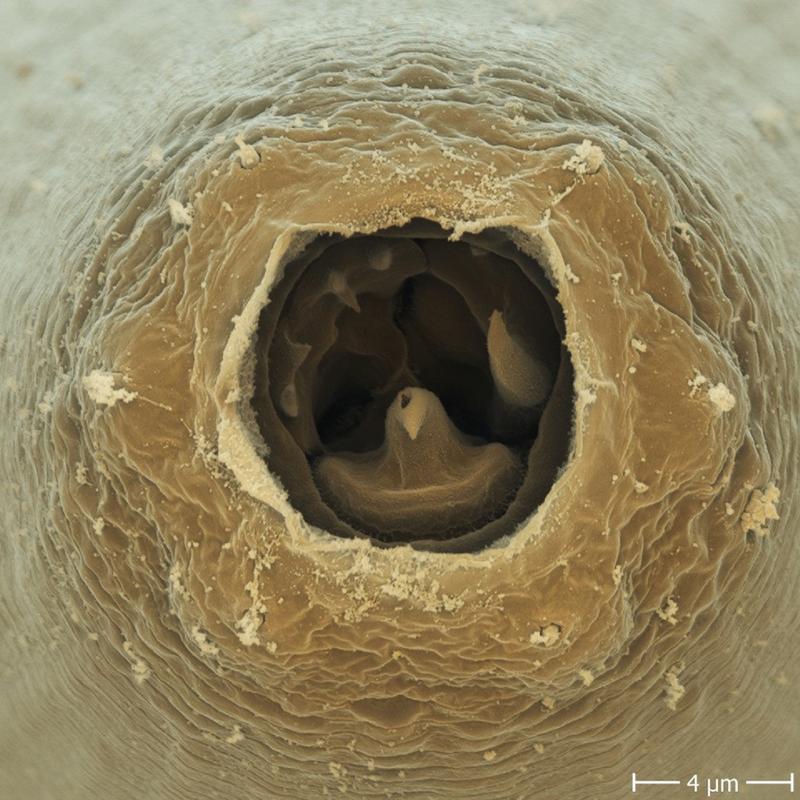 P. pacificus nematode showing its teeth.