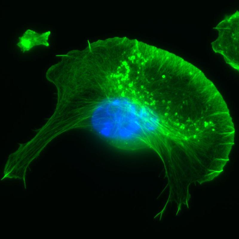 Aktinzytoskelett (grün) einer migrierenden Zelle mit Zellkern (blau).