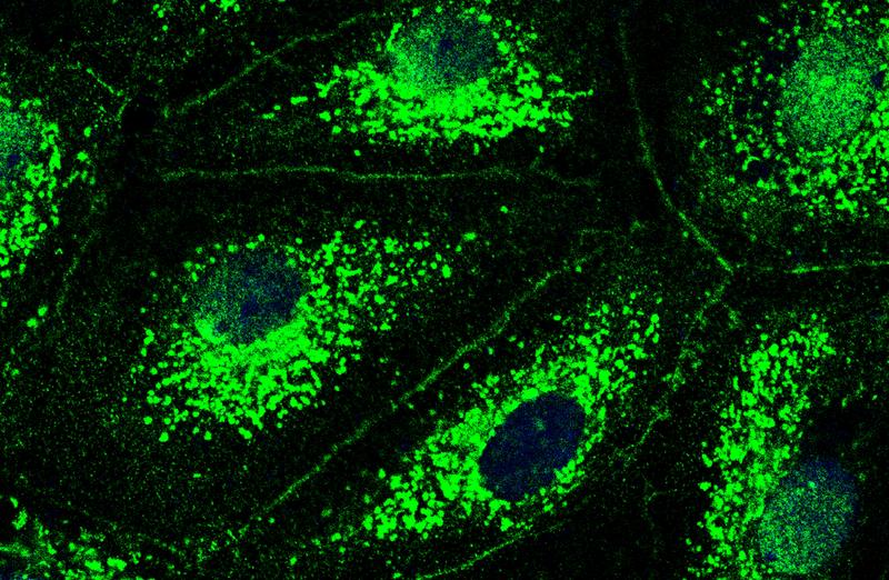 Fluoreszenzmikroskopisches Bild von Zellen der Lungen-Blutgefäße mit CFTR-Kanal (grün).  Zellkerne erscheinen als runde, dunkle Flecken, Zellmembranen als feine Linien.