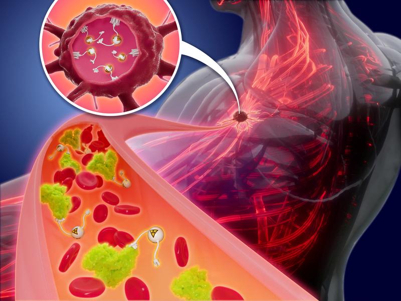 Die zusätzliche Bindung an das im Blutplasma vorkommende Albumin (grün) vergrößert den radioaktiven Molekülkomplex. Damit verlängert sich seine Zirkulationszeit im Blut und die Dosis der direkt am Tumor abgegebenen Alphastrahlung steigt.