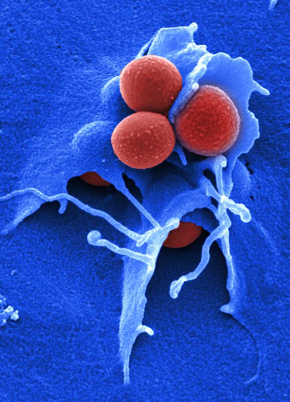 Invasion von Staphylococcus aureus in eine Wirtszelle