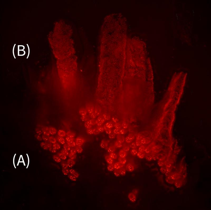 Fluorescence microscope image of cells in intestinal epithelium. (A) Stem cells in the deep crypts at the bottom of intestinal epithelium (ring-shaped structures) and (B) stem cell-derived epithelial cells growing upward and enveloping intestinal villi.