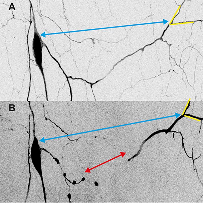 Durch genaue Analysen der Dendritenlängen (blaue/rote Pfeile) und Verästelungswinkel (gelb) wies das Team Kräfte nach, die während des Prunings auf die Dendriten wirken; A) vor und B) nach der Abtrennung der Dendriten durch Pruning.