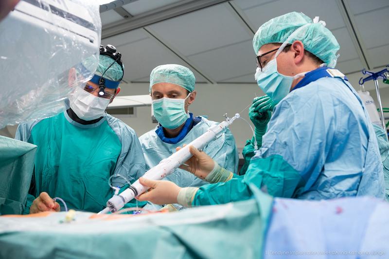 Mit Hilfe eines stabförmigen Introducers bringen die Experten die Mitralklappen-Prothese ins Herz