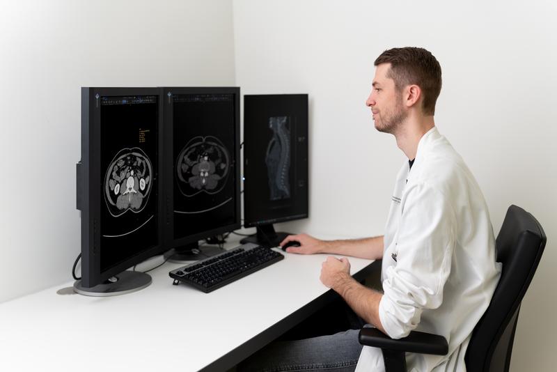Anhand von CT-Bildern wird ein möglicher Rückgang der Skelettmuskulatur analysiert. 