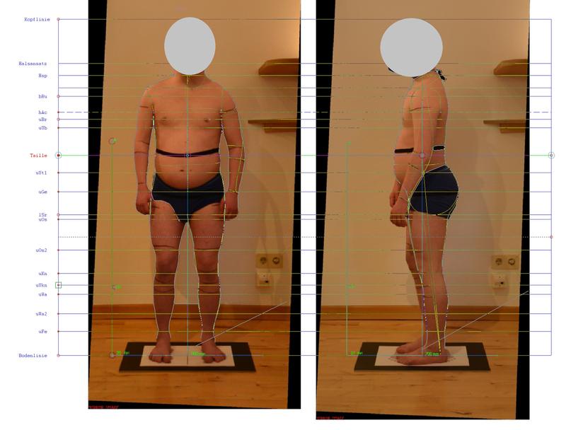 Carrying out a patient screening with digital measurement. Photo: DITF