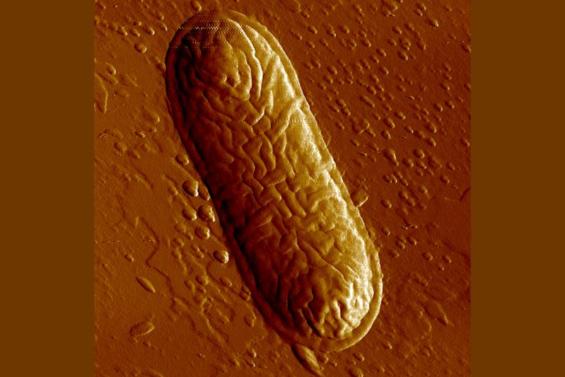  The expression of B4galnt2 in the intestinal mucosa can be favoured by various pathogens, which can lead to inflammation caused by, for example, a newly discovered subspecies of the bacterium Morganella morganii (pictured).