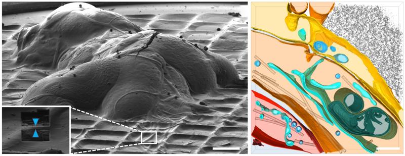 3D-Darstellung des Kryo-ET eines peripheren Nervs der Fruchtfliege