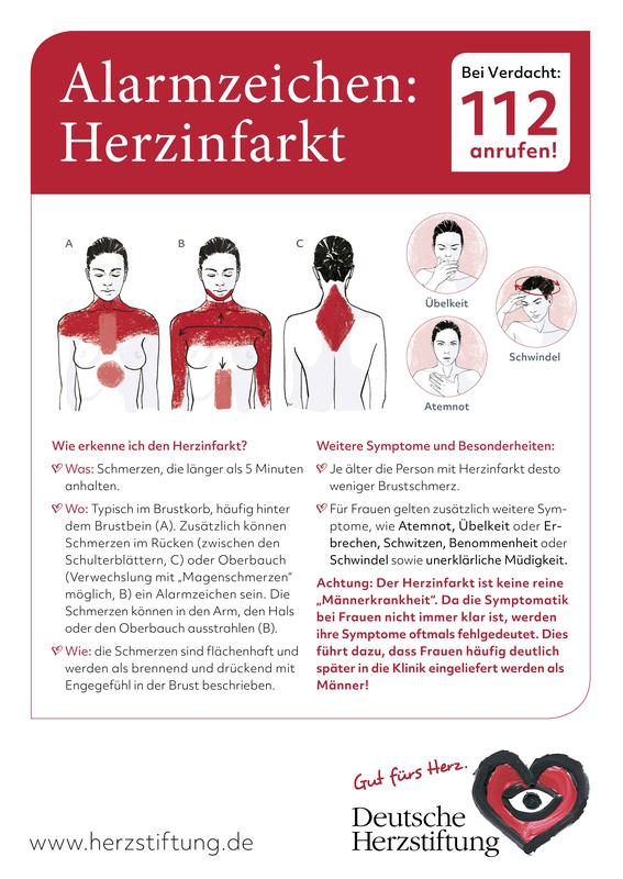 Darstellung der Herzinfarkt-Symptome.