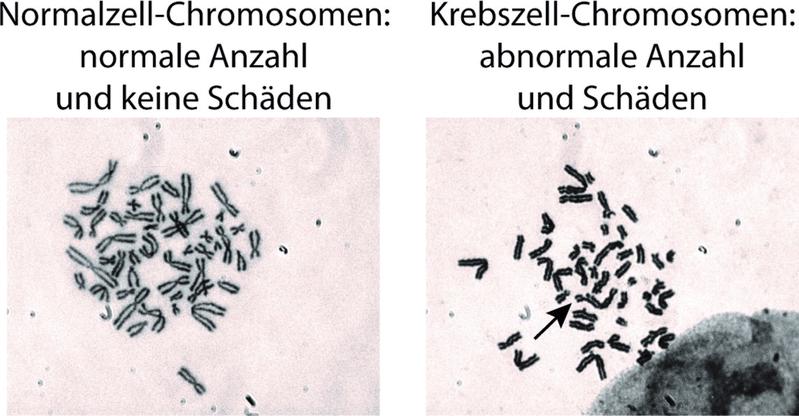 Abbildung: Normalzell-Chromosomen (links) und Krebszell-Chromosomen (rechts). 