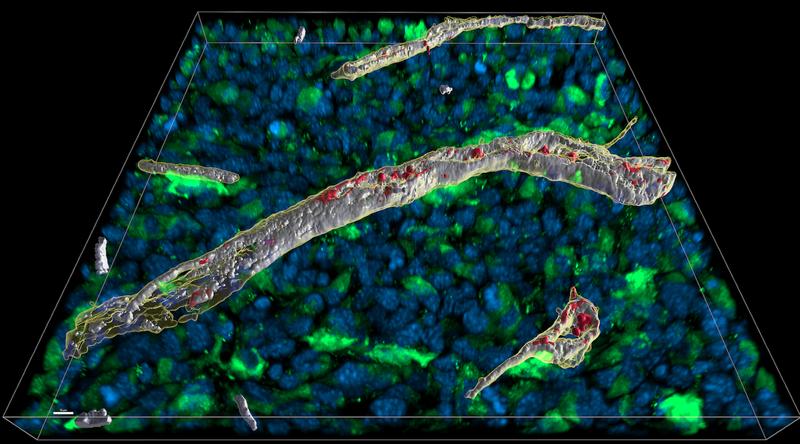 Mikroskopische Analyse eines 16µm dicken Schnitts durch ein Gewebe, in dem der Immunbotenstoff Interferon gamma freigesetzt wurde: Weiß sind räumlich die Bereiche im Blutgefäß zu sehen, in denen Interferon und Heparansulfat aneinander binden.