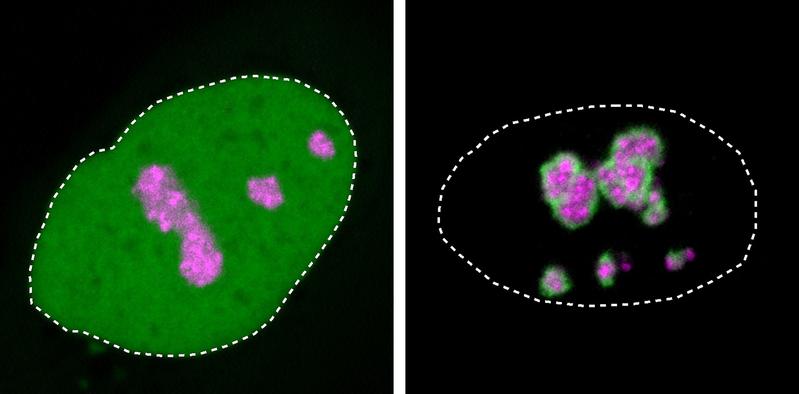 Detail von Zellkernen in humanen Zellkulturen: Das HMGB1-Protein (grün) ist normalerweise im Zellkern verteilt (gepunktete Linie). Rechts ist die Mutation von HMGB1 zu sehen, die sich am Kernkörperchen (pink) eine harte Schicht aufbaut.
