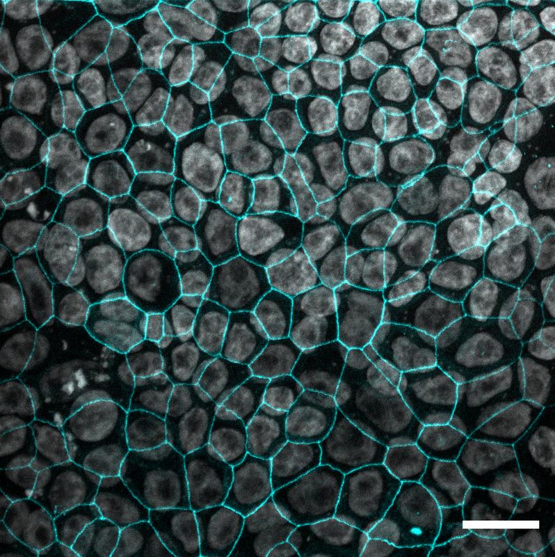Fluoreszenzfärbung von Arlo-Zellen. Das Bild zeigt die Überlagerung einer Färbung der Zellkerne (grau) sowie des Tight Junction Protein 1 (blau) und wurde mit einem konfokalen Laser-Scanning-Mikroskop aufgenommen.