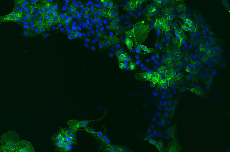  Hepatomazellen, die EGFR überexprimieren, sind hier zu sehen in grün. In blau ist der Zellkern angefärbt.  