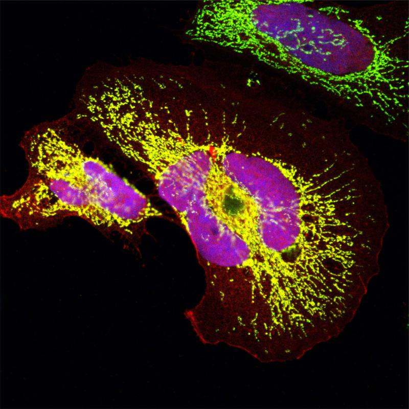 Ein evolutionär junges Protein, dass sich de novo in Altweltaffen entwickelt hat: Das Miniprotein in Mitochondrien (grün) & im Zellkern (blau) wurde in Humanzellen überexprimiert. Signal des Proteins überschneidet sich mit beiden Bereichen (gelb & rosa).