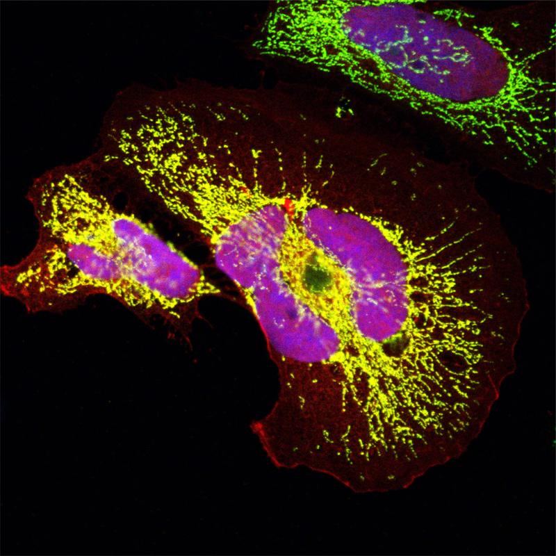 Ein evolutionär junges Protein, dass sich de novo in Altweltaffen entwickelt hat: Das Miniprotein in Mitochondrien (grün) & im Zellkern (blau) wurde in Humanzellen überexprimiert. Signal des Proteins überschneidet sich mit beiden Bereichen (gelb & rosa).