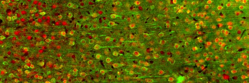 Epifluoreszenzbild der hinteren Inselrinde der Maus: Die Neuronen exprimieren ein kalziumempfindliches Protein grün und einen allgemeinen neuronalen Marker rot.