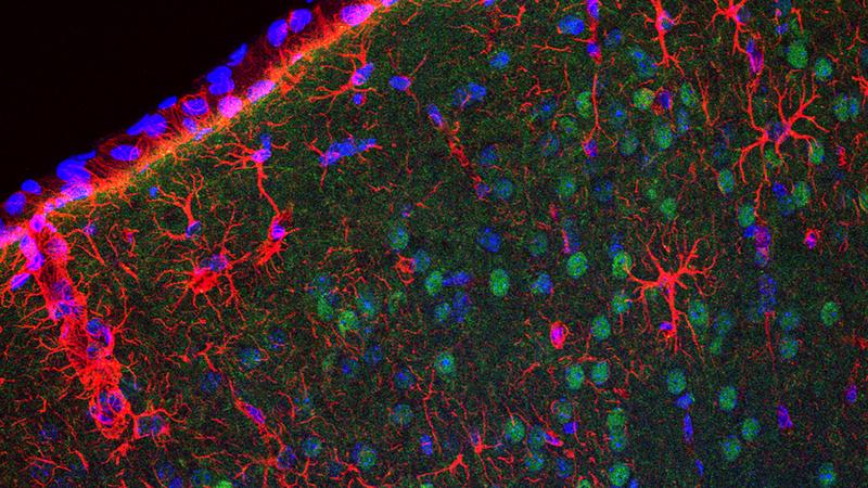 Neurons (green) in the male brain react differently to lowered insulin signaling.