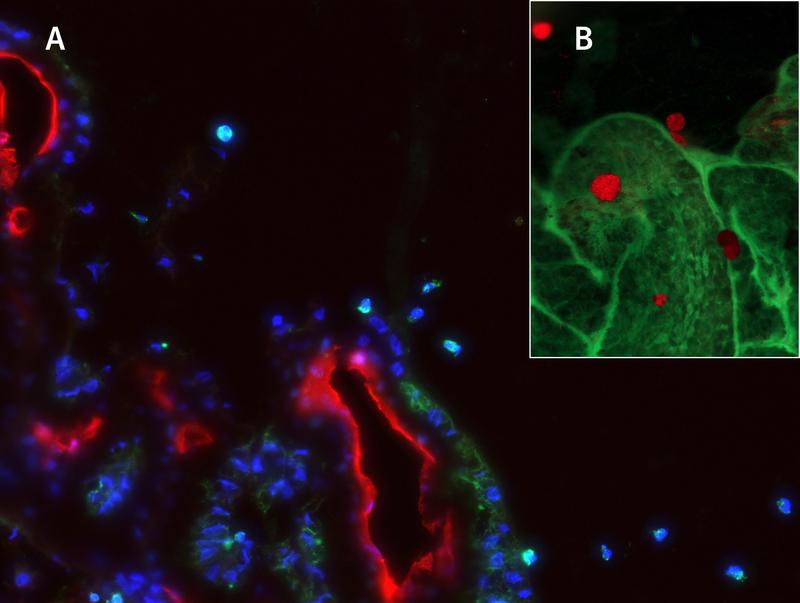 Die Wanderung von Immunzellen bei der Entstehung des diabetischen Katarakts. (A) Immunzellen, die die Epithelzellen des Ziliarkörpers passieren. (B) Anhängende Immunzellen (rot) auf dem Ziliarkörper (grün) in einem Flachpräparat.