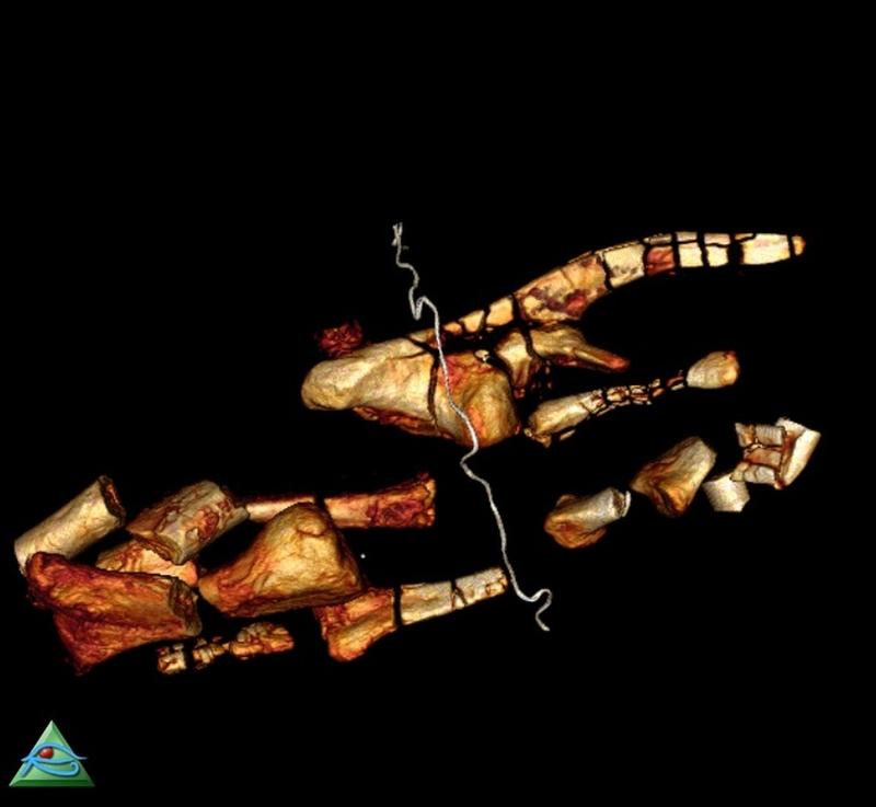 Virtuelle Rekonstruktion von Knochen von Dysalotosaurus aus einer der Bambustrommeln