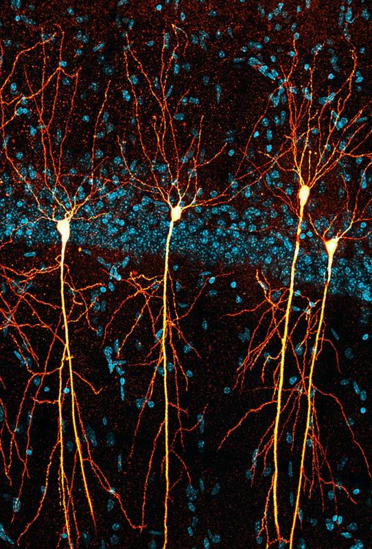 Die Neurone im Hippocampus transgener Mäuse konnten durch die Behandlung mit Nitarsone erhalten werden 