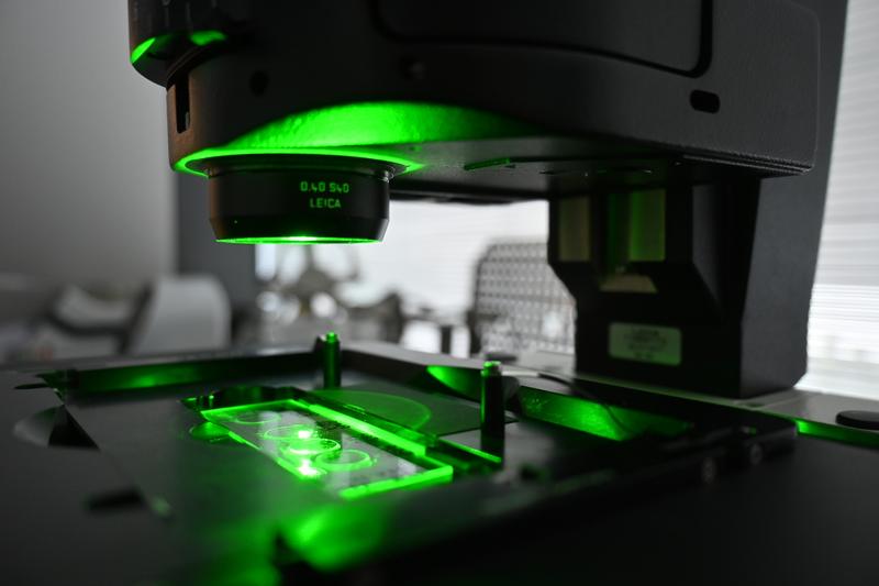 Zur fluoreszenzmikroskopischen Analyse des PURA-Proteins wird auch grünes Laserlicht eingesetzt
