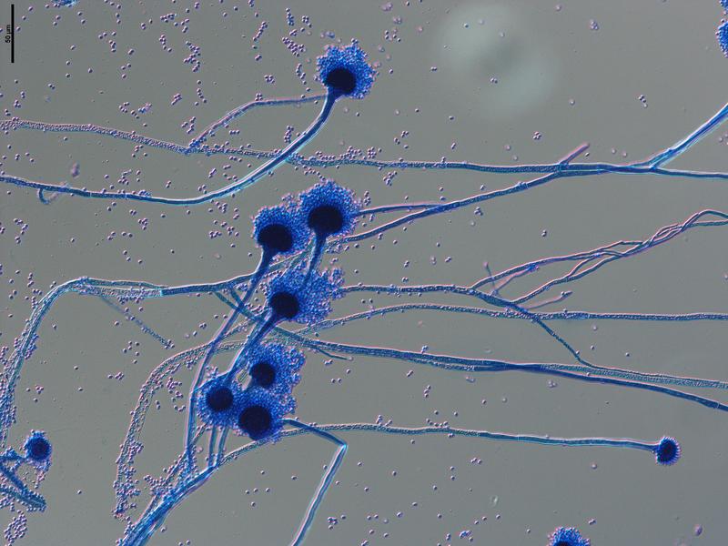 Aspergillus fumigatus ist ein Pilz, der in der Umwelt häufig vorkommt. Bei immungeschwächten Menschen kann er eine invasive Pilzinfektion auslösen, die schwierig zu behandeln ist. 