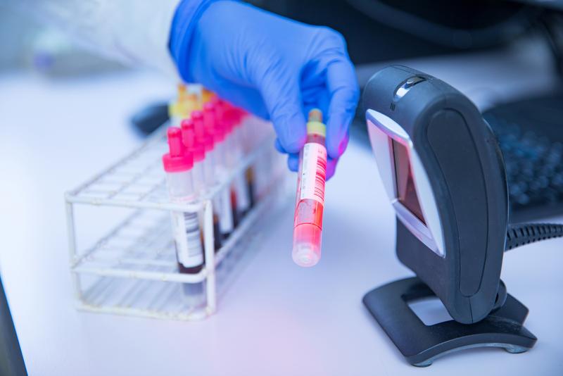 The photo shows the scanning of a blood sample in a laboratory at CiiM. 