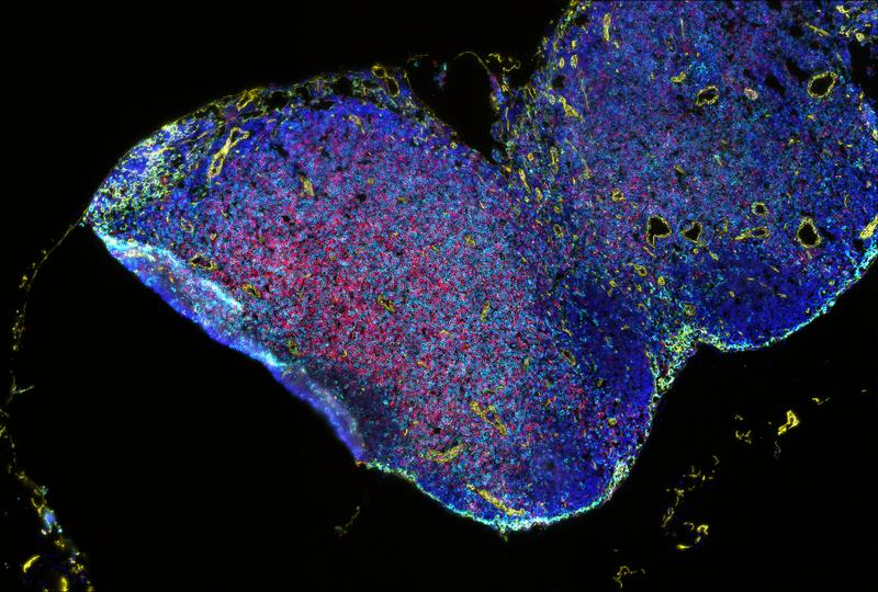 Mouse lymph nodes: The colors represent fluorescent markers that bind to specific molecules on the surface or inside individual immune cells. 