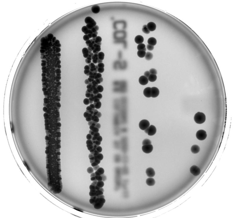 Darmbakterien in einer Petrischale: Unser Mikrobiom beeinflusst viele Prozesse im Körper. Eine aktuelle Studie zeigt, dass die enorme Regenerationsfähigkeit der Leber außer Kraft gesetzt wird, wenn das Mikrobiom gestört ist – etwa durch Antibiotika.