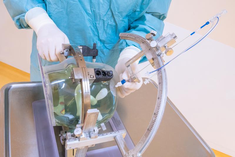 Der Laserkatheter wird (hier am Kopfmodell) stereotaktisch geführt über eine wenige Millimeter große Öffnung der Schädeldecke zielgenau im Tumor platziert. Anschließend erfolgt die Laserbehandlung am intraoperativen Kernspintomografen.